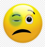 1-14565_emoji-with-black-eye.jpg