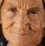 what-causes-wrinkles-1.jpg